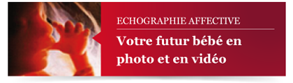 Echographie 4D