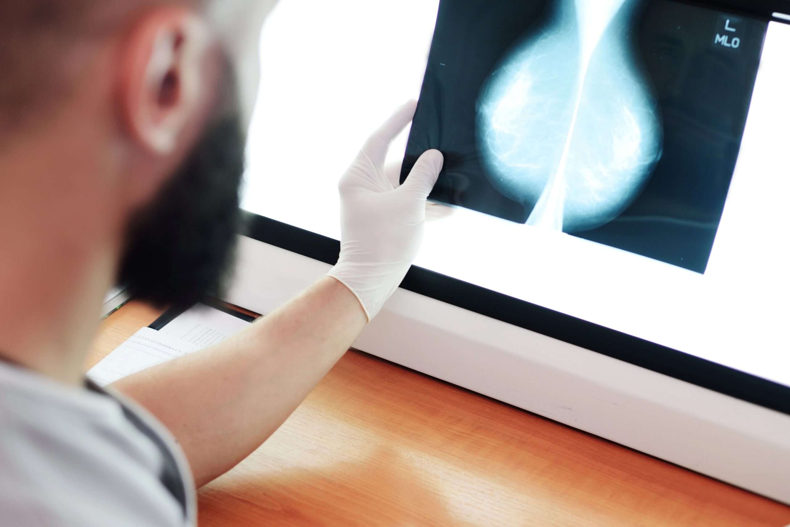 MAMMOGRAPHE 3D DERNIÈRE GÉNÉRATION AU LOUISE MEDICAL CENTER